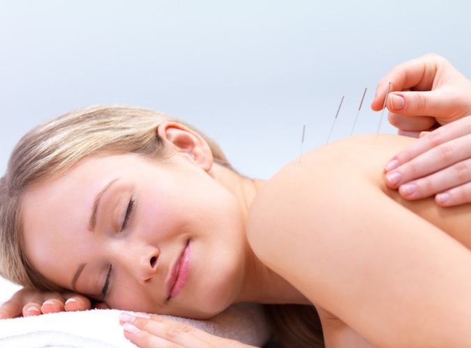 Acupuntura